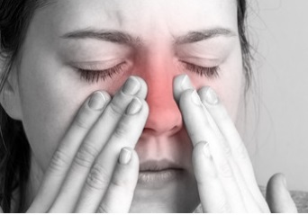 Sinusitis